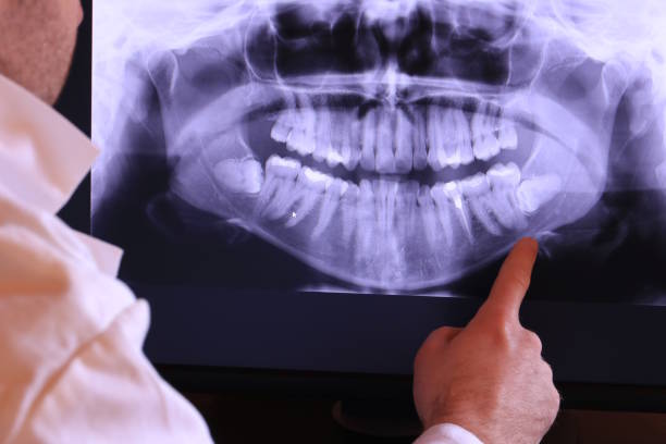 Best Emergency Denture Repair in Faison, NC